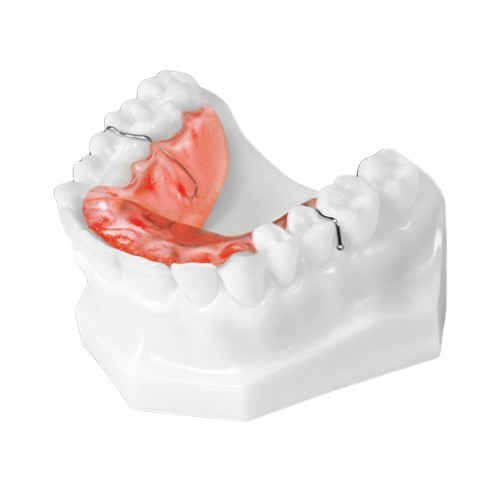 Bite Plate appliance that rests against the roof of the mouth.