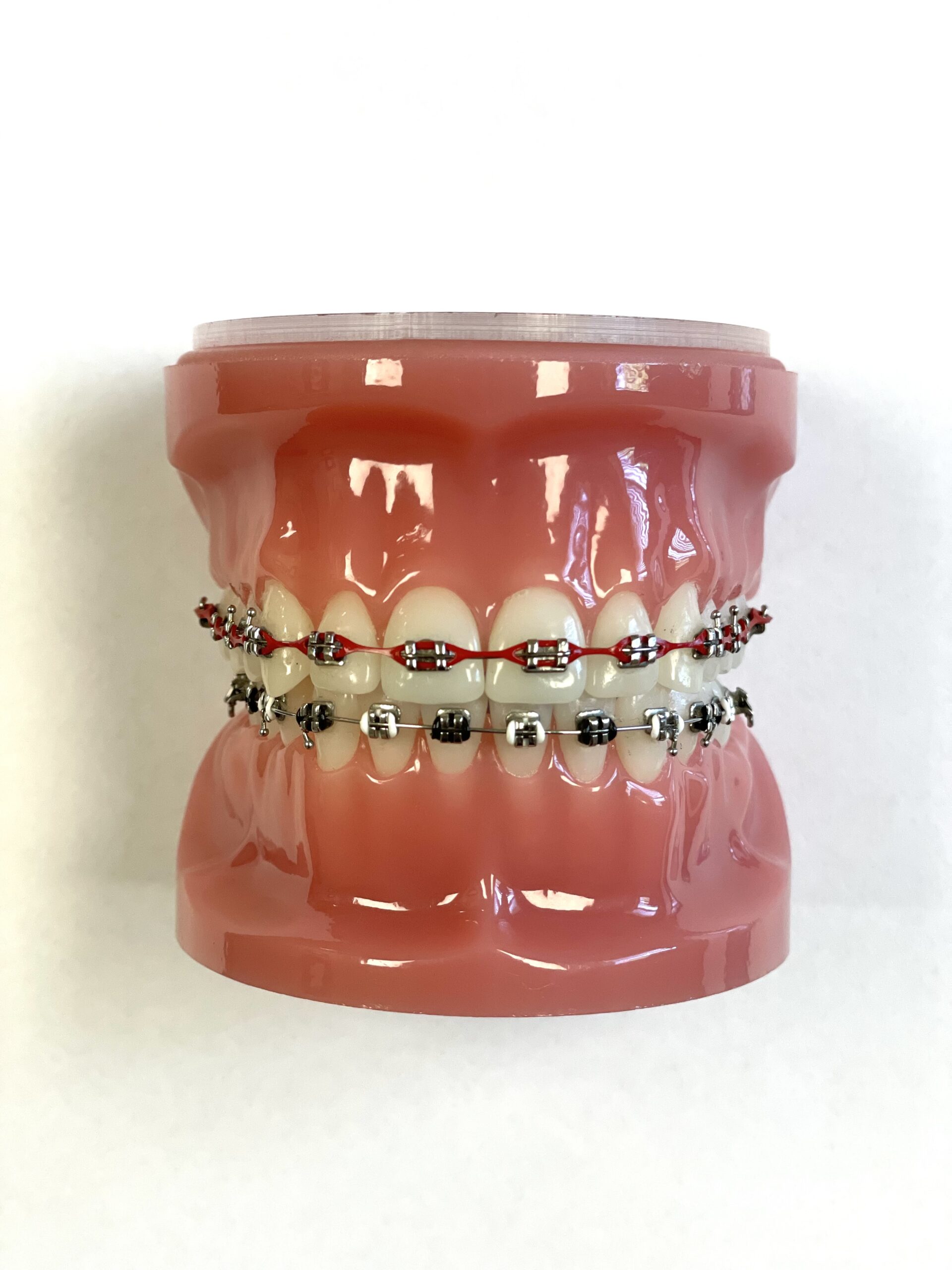 Traditional metal braces with colors.