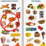 Comparison of foods safe for braces and foods that should be avoided.