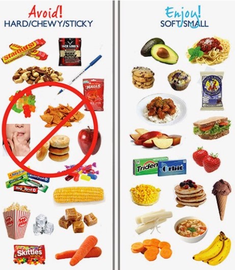 Foods to Avoid with Braces